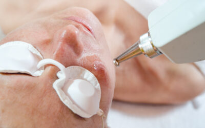 Is Laser Rejuvenating Skin Treatment Safe for All Skin Types?