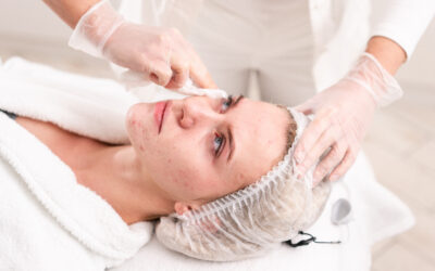 Breaking Down NeoClear Acne Treatment: What Makes It So Effective?